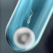 石家庄三大助孕公司是哪三家（试管助孕精选笔记）