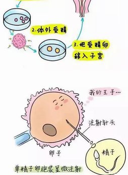 2026年未婚去安阳做试管的全部费用要多少？